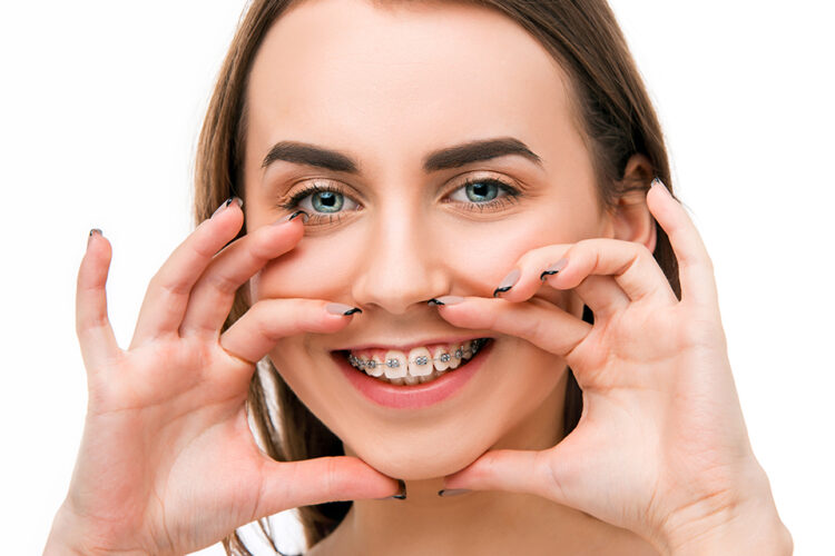 aparatul-dentar-la-adulti
